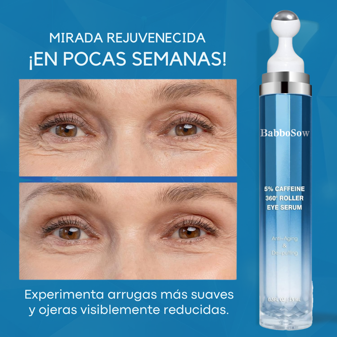 Anti-Ojeras 3D